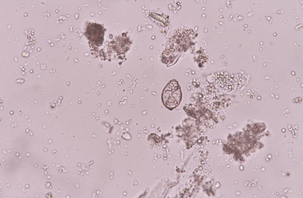 Человеческий Т-клеточный лимфотропный вирус типа 1 (HTLV-1) и Opisthorchis Viverrini