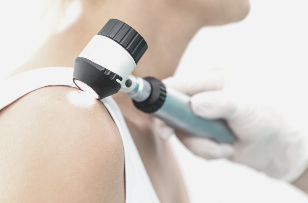 Рак кожи: базалиома