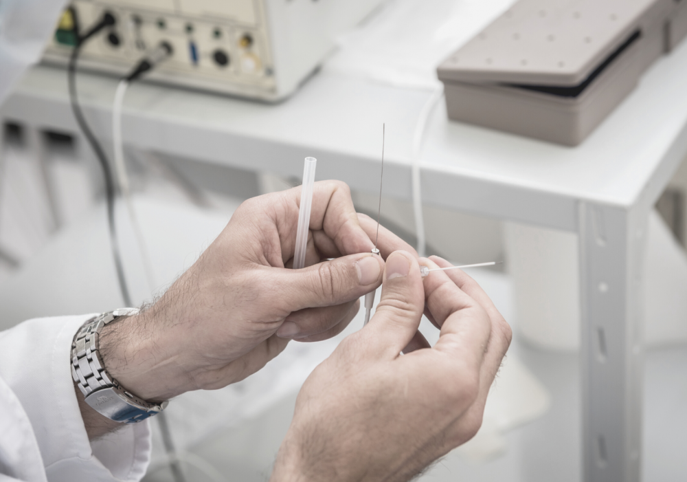 Радиочастотная абляция