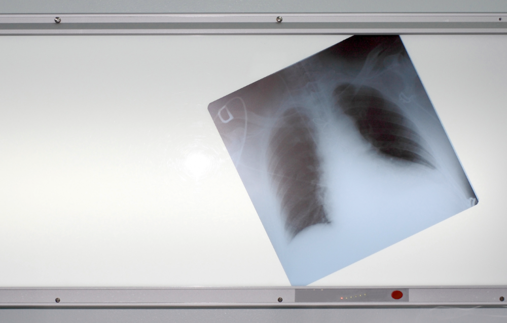 Как курение влияет на организм человека?