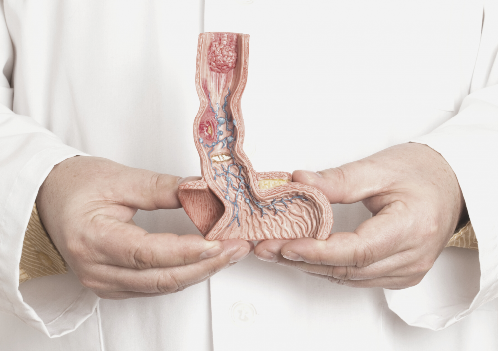 Рак пищевода