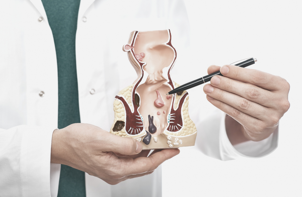 Плоскоклеточный рак анального канала